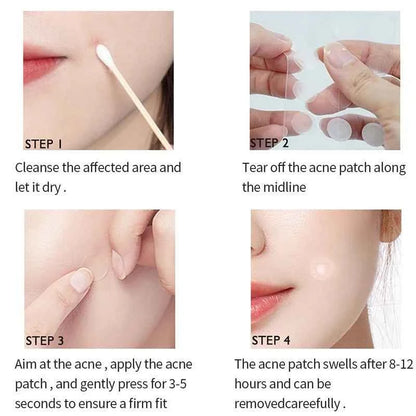 72/180pcs Hydrocolloid Acne Patch Waterproof Acne Removing PU Film Face Printing Spots Marks Invisible Acne Cleansing Patch